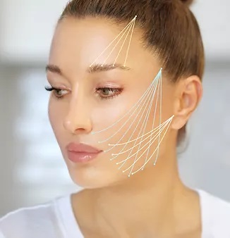 Thread lifting is the minimal invasive method to refine yourself